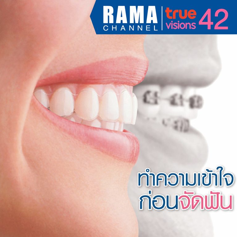 ทำความเข้าใจก่อนจัดฟัน