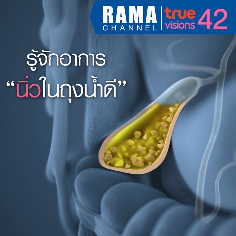 อาการนิ่วในถุงน้ำดี สาเหตุและปัจจัยเสี่ยงที่ควรรู้