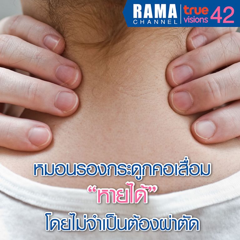 หมอนรองกระดูกคอเสื่อม "หายได้" โดยไม่จำเป็นต้องผ่าตัด