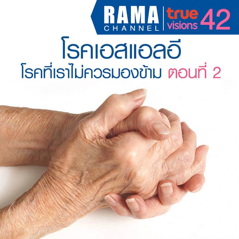 โรคเอสแอลอี โรคที่เราไม่ควรมองข้าม