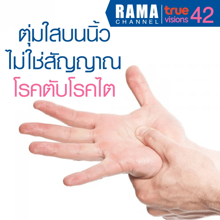 ตุ่มใสบนนิ้ว ตุ่ม
