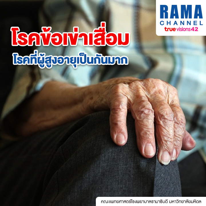 โรคข้อเข่าเสื่อม โรคที่ผู้สูงอายุเป็นกันมาก