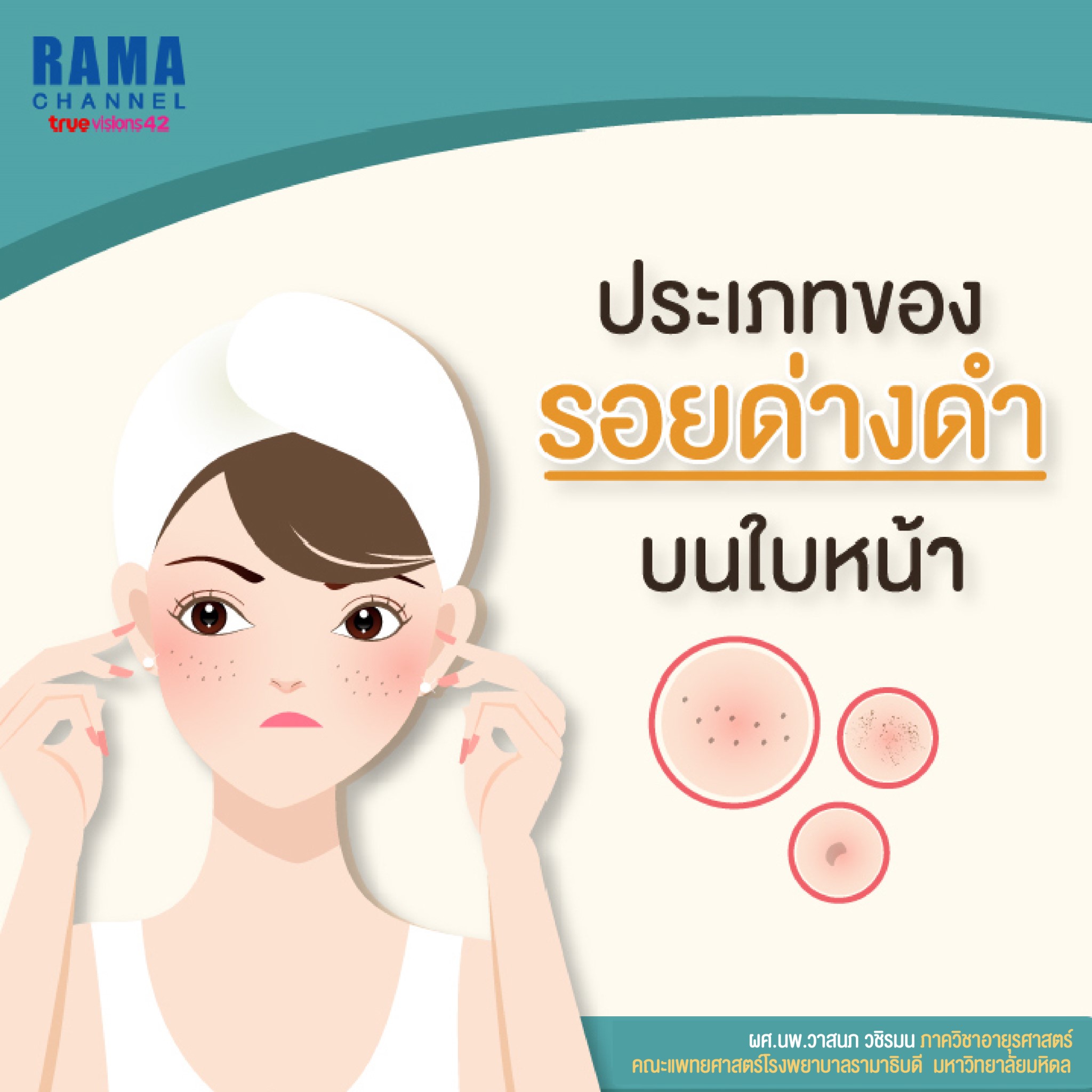 ประเภทรอยดำบนใบหน้า1