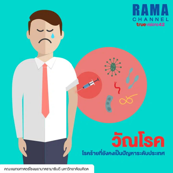 วัณโรค