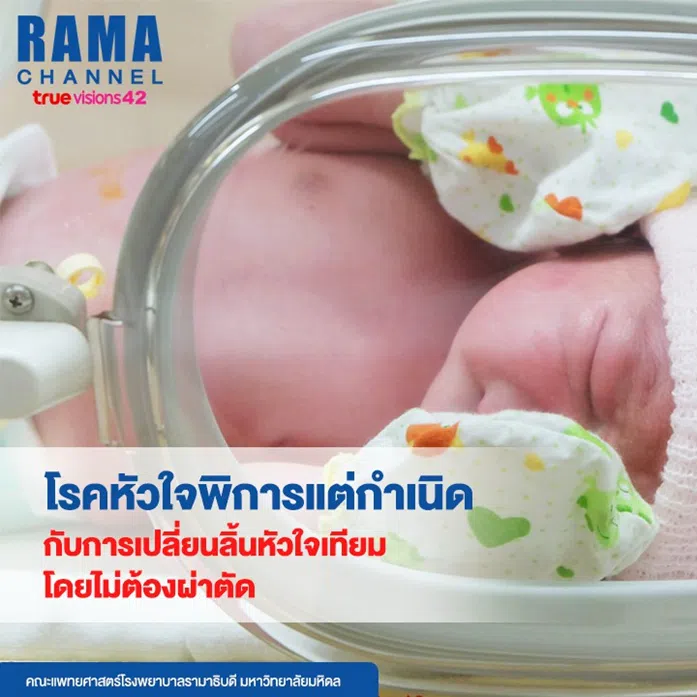 โรคหัวใจพิการแต่กำเนิด กับการเปลี่ยนลิ้นหัวใจเทียมโดยไม่ต้องผ่าตัด