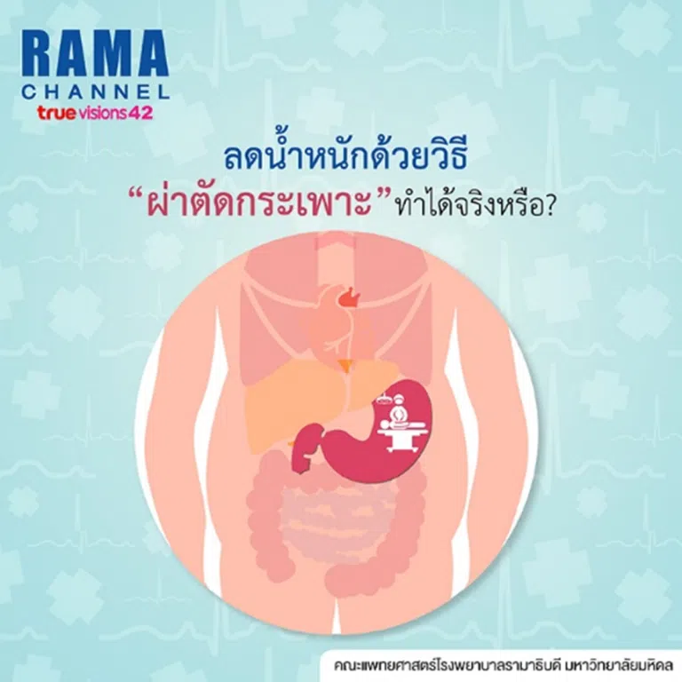 ลดน้ำหนัก