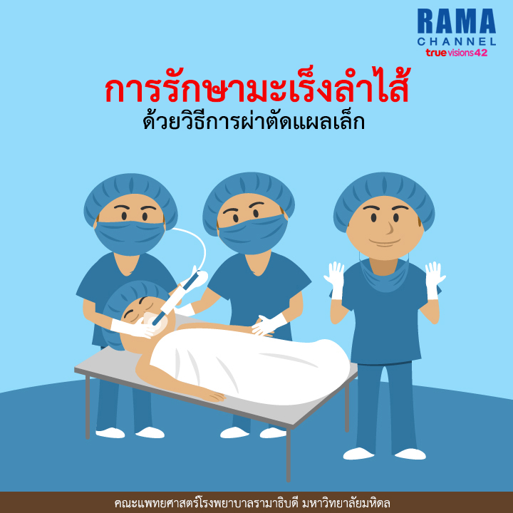10การรักษามะเร็งลำไส้