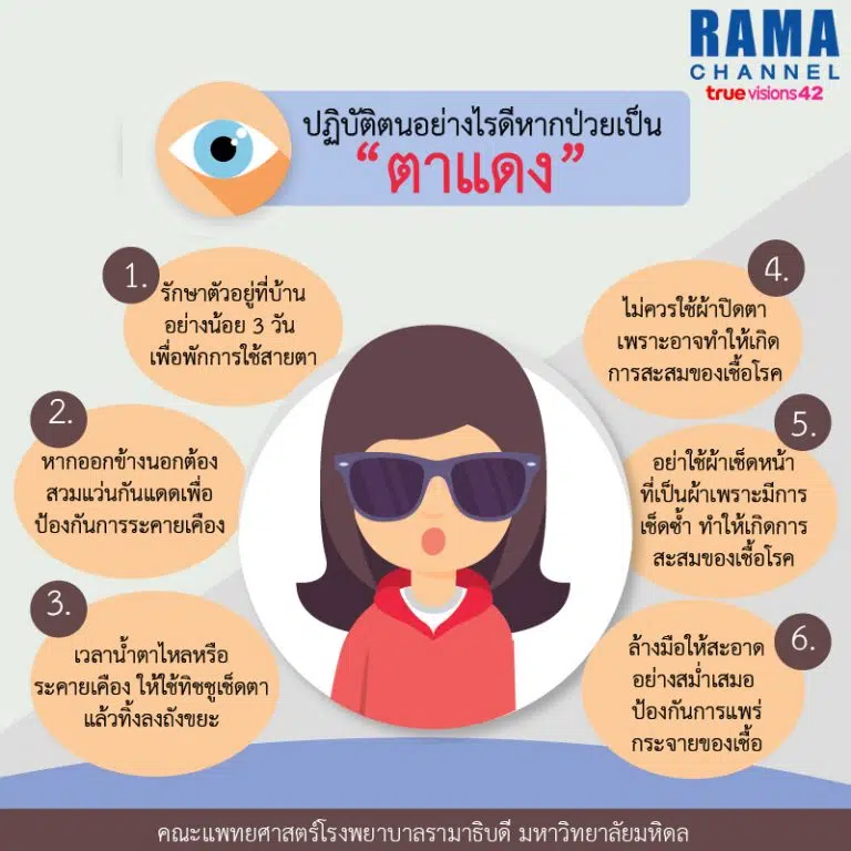 ปฏิบัติตนอย่างไรดี หากป่วยเป็น “โรคตาแดง”