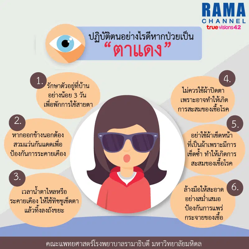 ปฏิบัติตนอย่างไรดี หากป่วยเป็น “โรคตาแดง”