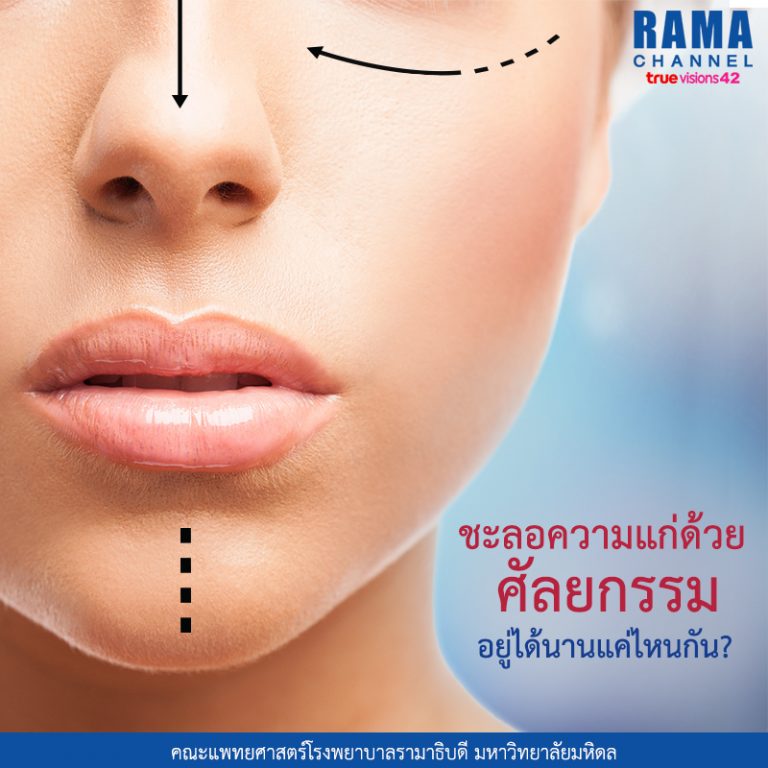 ชะลอความแก่ ด้วยศัลยกรรม อยู่ได้นานแค่ไหนกัน?