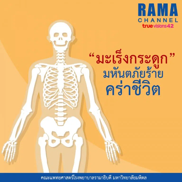 มะเร็งกระดูก มหันตภัยร้ายคร่าชีวิต