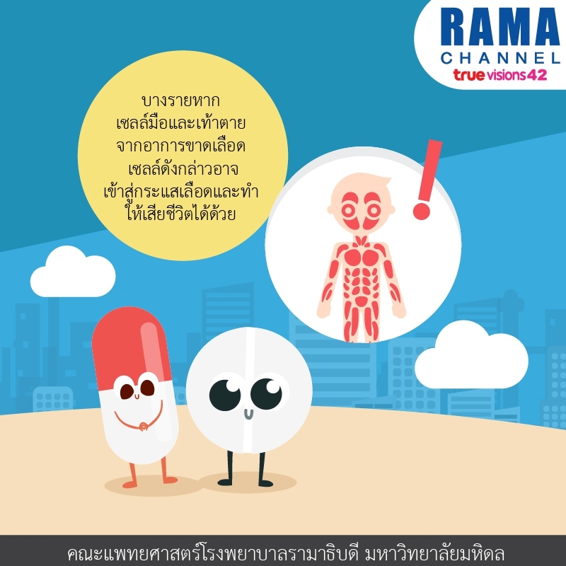 ผลข้างเคียงของ ยารักษาไมเกรน ที่อาจถึงขั้นเสียมือและเท้า