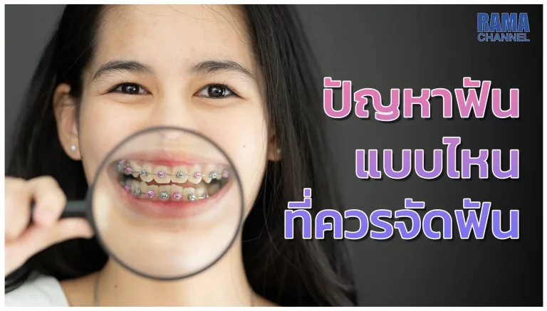 บทความ เรื่อง การ จัดฟัน จะช่วยให้มี ฟัน สวยเป็นที่นิยมมากเพราะนอกจากจะช่วยแก้ปัญหาฟันไม่สวยแล้ว ยังช่วยเพิ่มความมั่นใจ และสร้างบุคลิกภาพที่ดีได้อีกด้วย