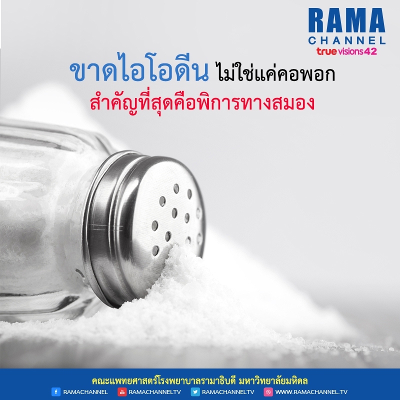 ขาดไอโอดีน ไม่ใช่แค่คอพอก สำคัญที่สุดคือพิการทางสมอง
