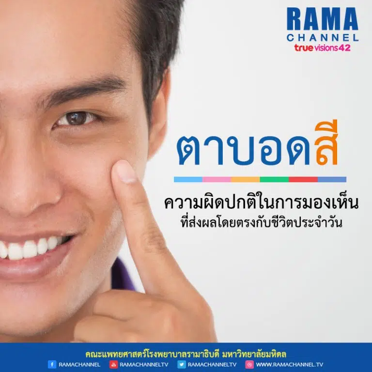 ตาบอดสี ความผิดปกติในการมองเห็น ที่ส่งผลโดยตรงกับชีวิตประจำวัน