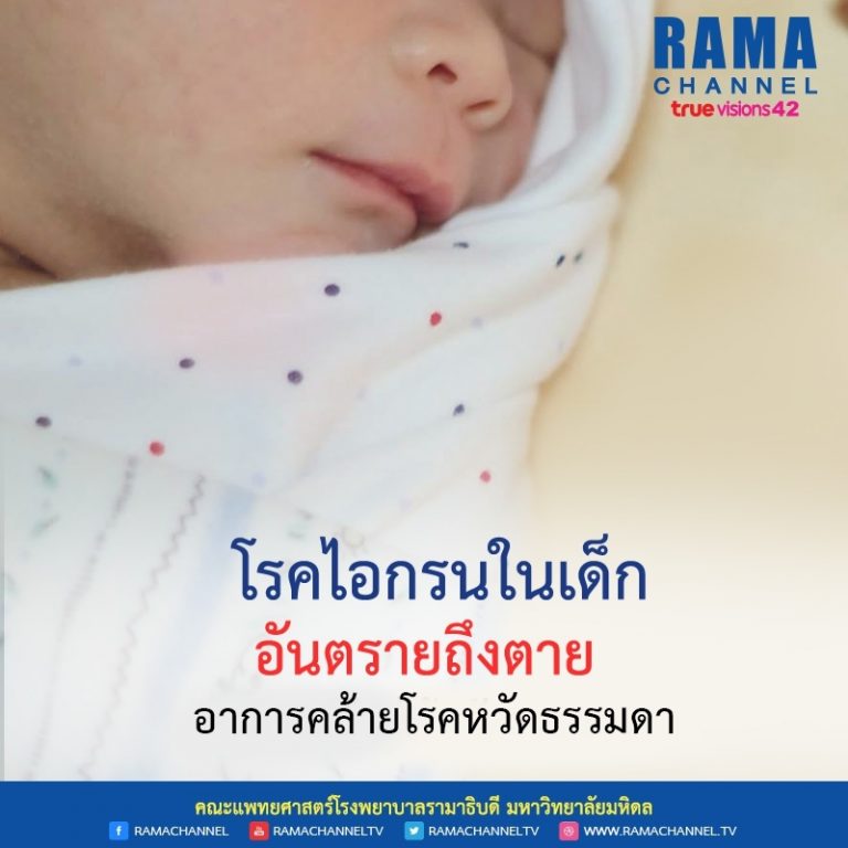 โรคไอกรน ในเด็กอันตรายถึงตาย อาการคล้ายโรคหวัดธรรมดา