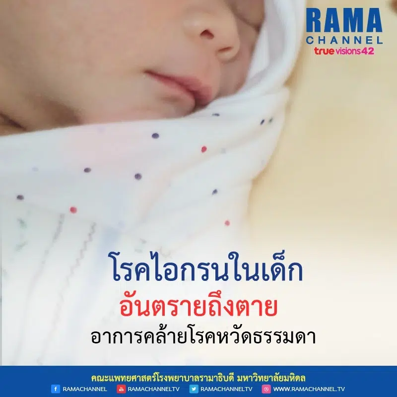 โรคไอกรน ในเด็กอันตรายถึงตาย อาการคล้ายโรคหวัดธรรมดา