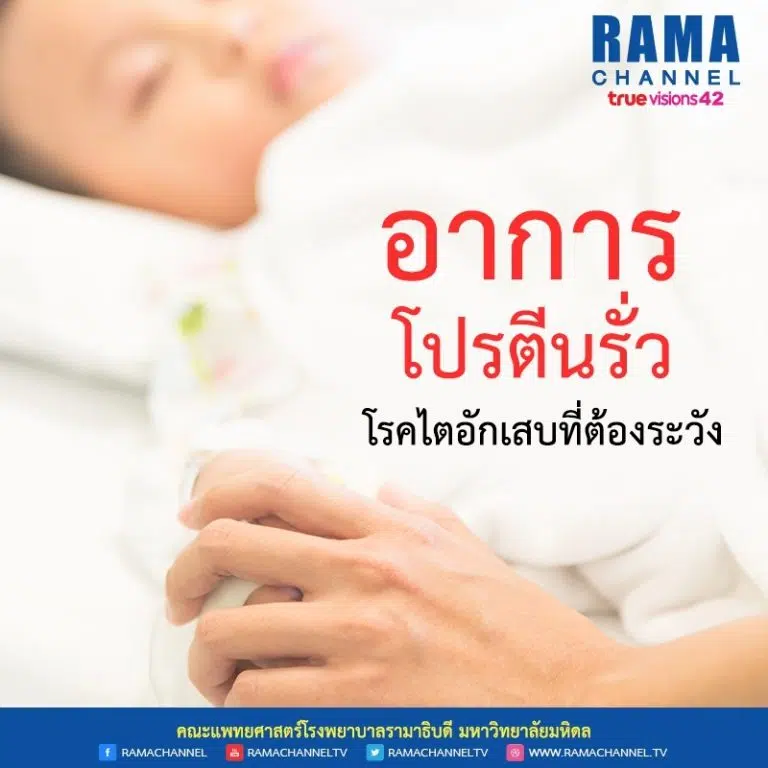 อาการโปรตีนรั่ว โรคไตอักเสบที่ต้องระวัง