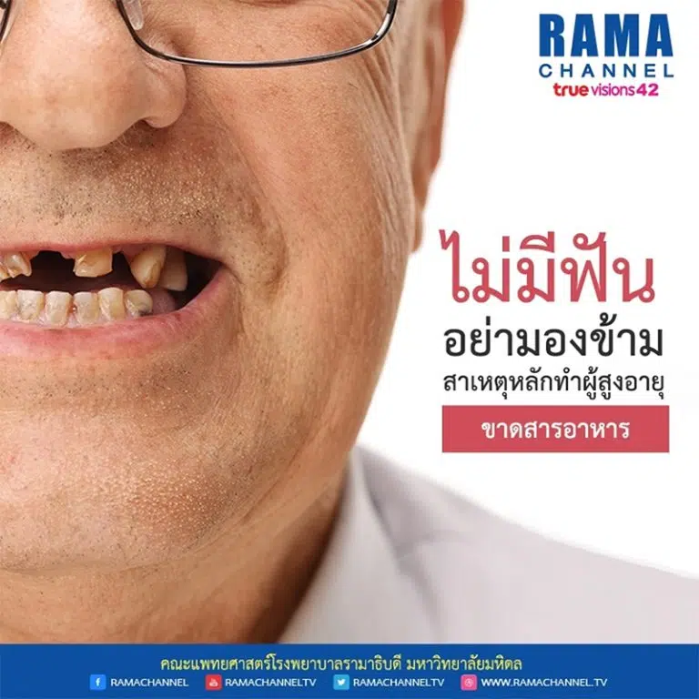 ไม่มีฟัน