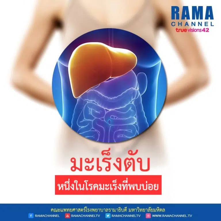 มะเร็งตับ อีกหนึ่งในโรคมะเร็งที่พบบ่อย