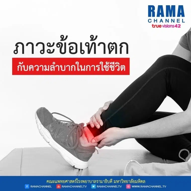 ภาวะข้อเท้าตก กับความลำบากในการใช้ชีวิต