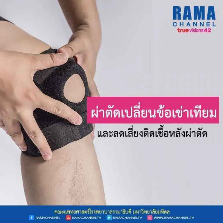 ผ่าตัดเปลี่ยนข้อเข่าเทียม และลดเสี่ยงติดเชื้อหลังผ่าตัด