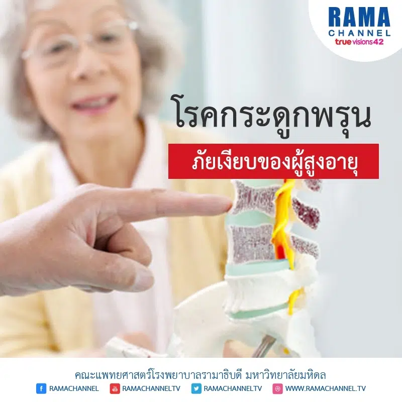 โรคกระดูกพรุน ภัยเงียบของผู้สูงอายุ