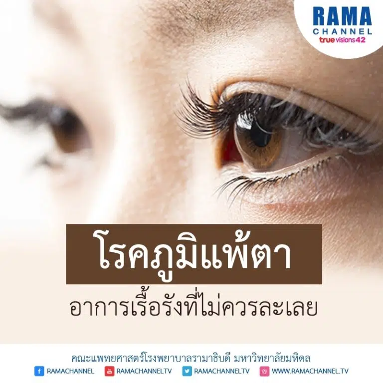 โรคภูมิแพ้ตา อาการเรื้อรังที่ไม่ควรละเลย