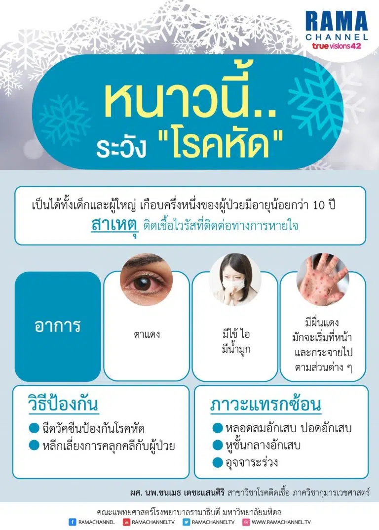หัด