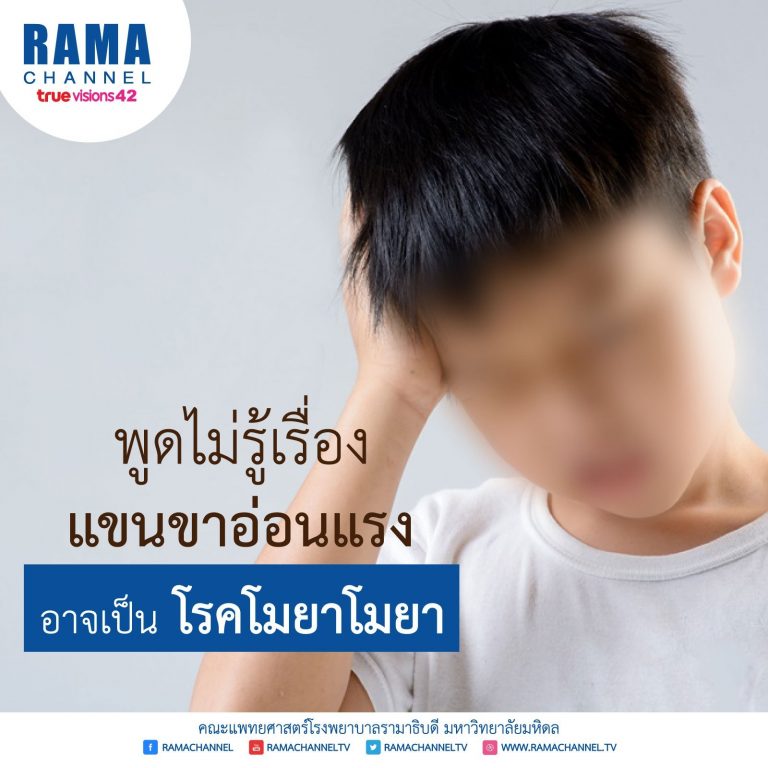พูดไม่รู้เรื่อง กล้ามเนื้ออ่อนแรง อาจเป็น โรคโมยาโมยา