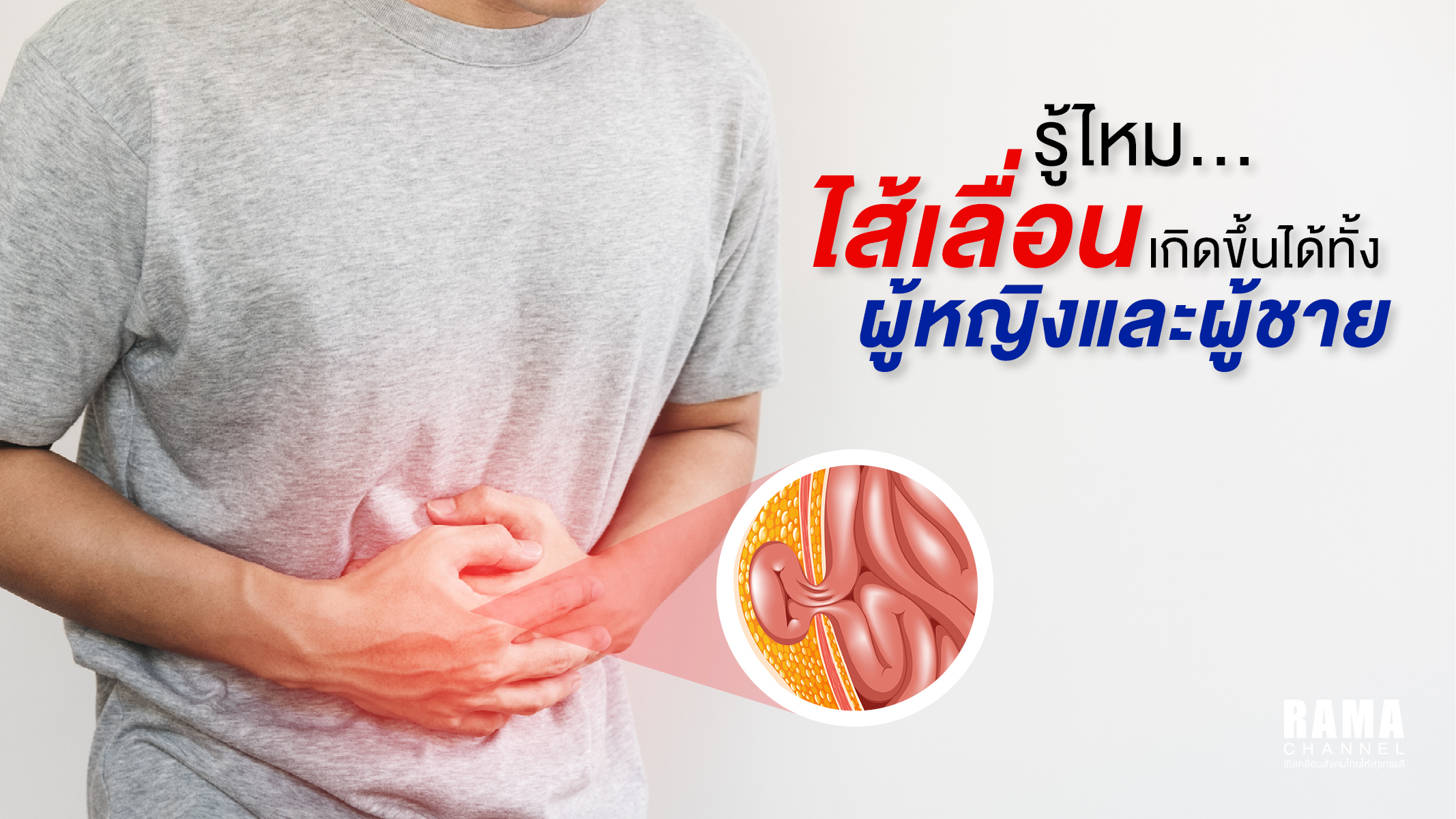 รู้ไหม...ไส้เลื่อน เกิดขึ้นได้ทั้งผู้หญิงและผู้ชาย