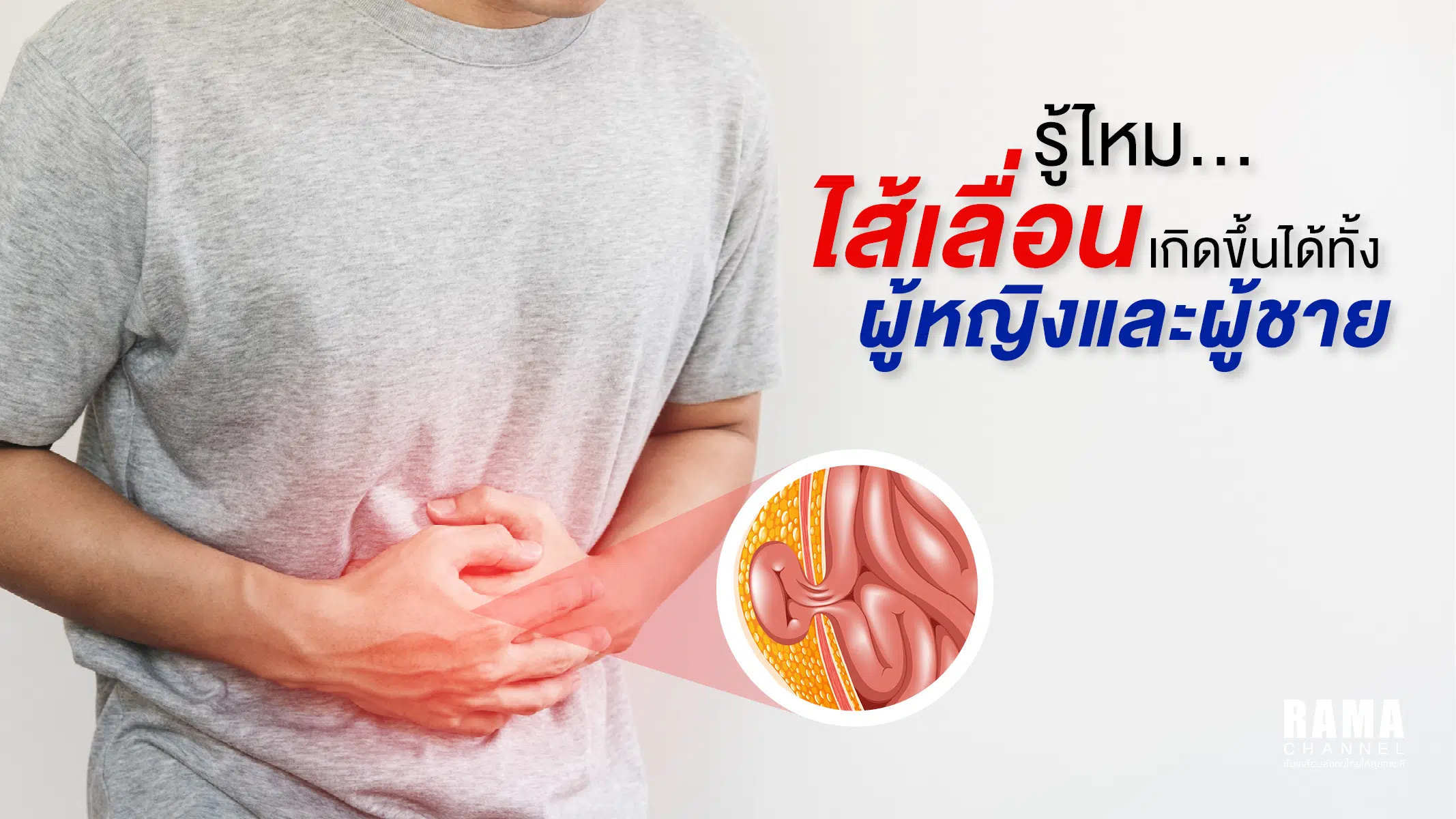 รู้ไหม...ไส้เลื่อน เกิดขึ้นได้ทั้งผู้หญิงและผู้ชาย