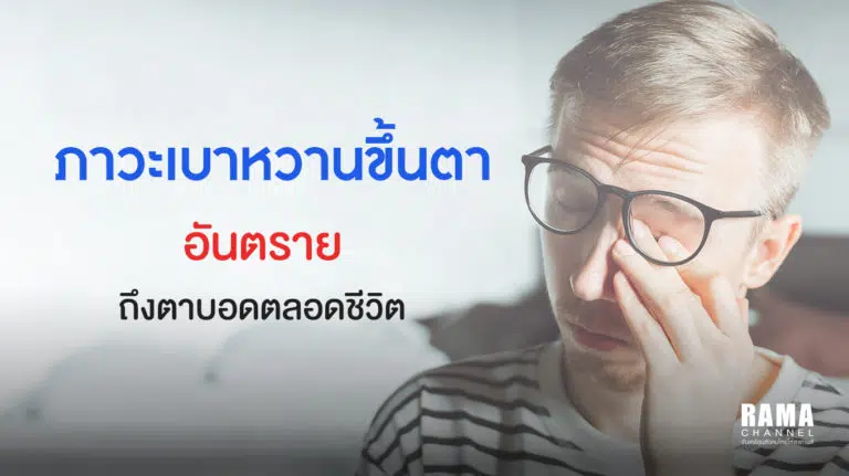 ภาวะเบาหวานขึ้นตา อันตรายถึงตาบอดตลอดชีวิต
