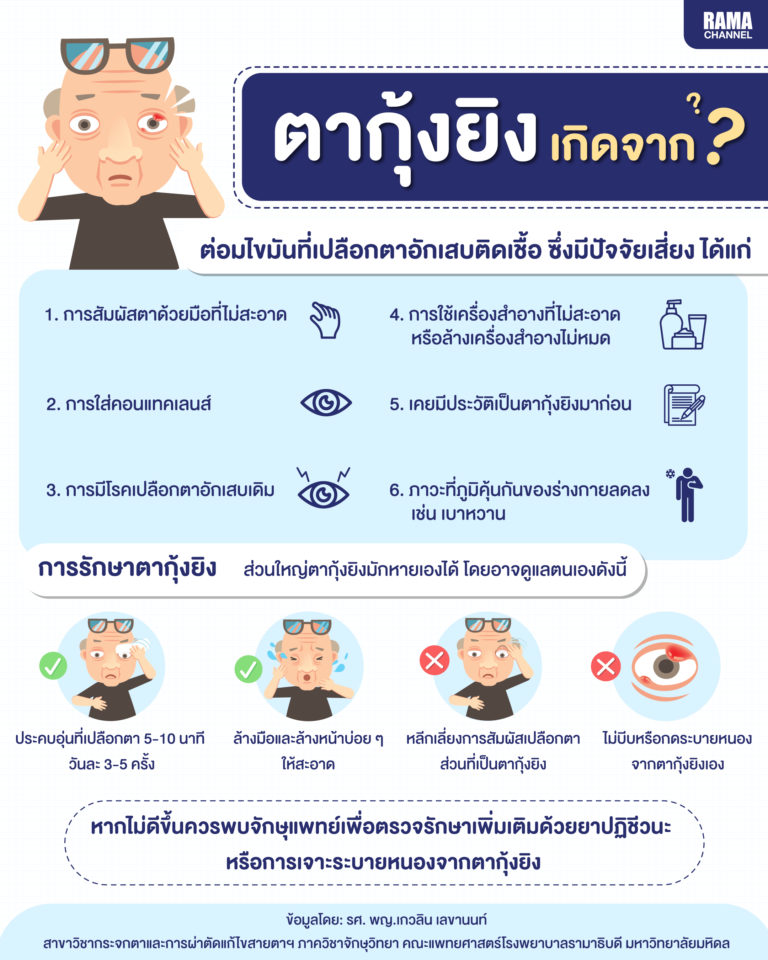 ตากุ้งยิง เกิดจากอะไร รักษาอย่างไร