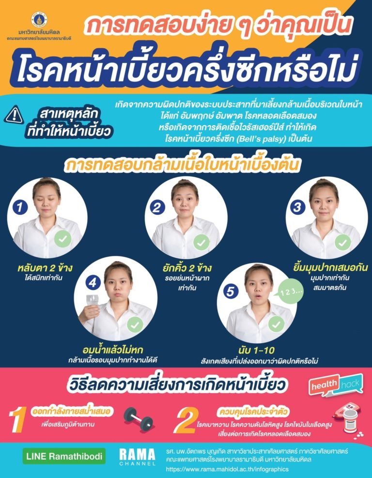 โรคหน้าเบี้ยวครึ่งซีก