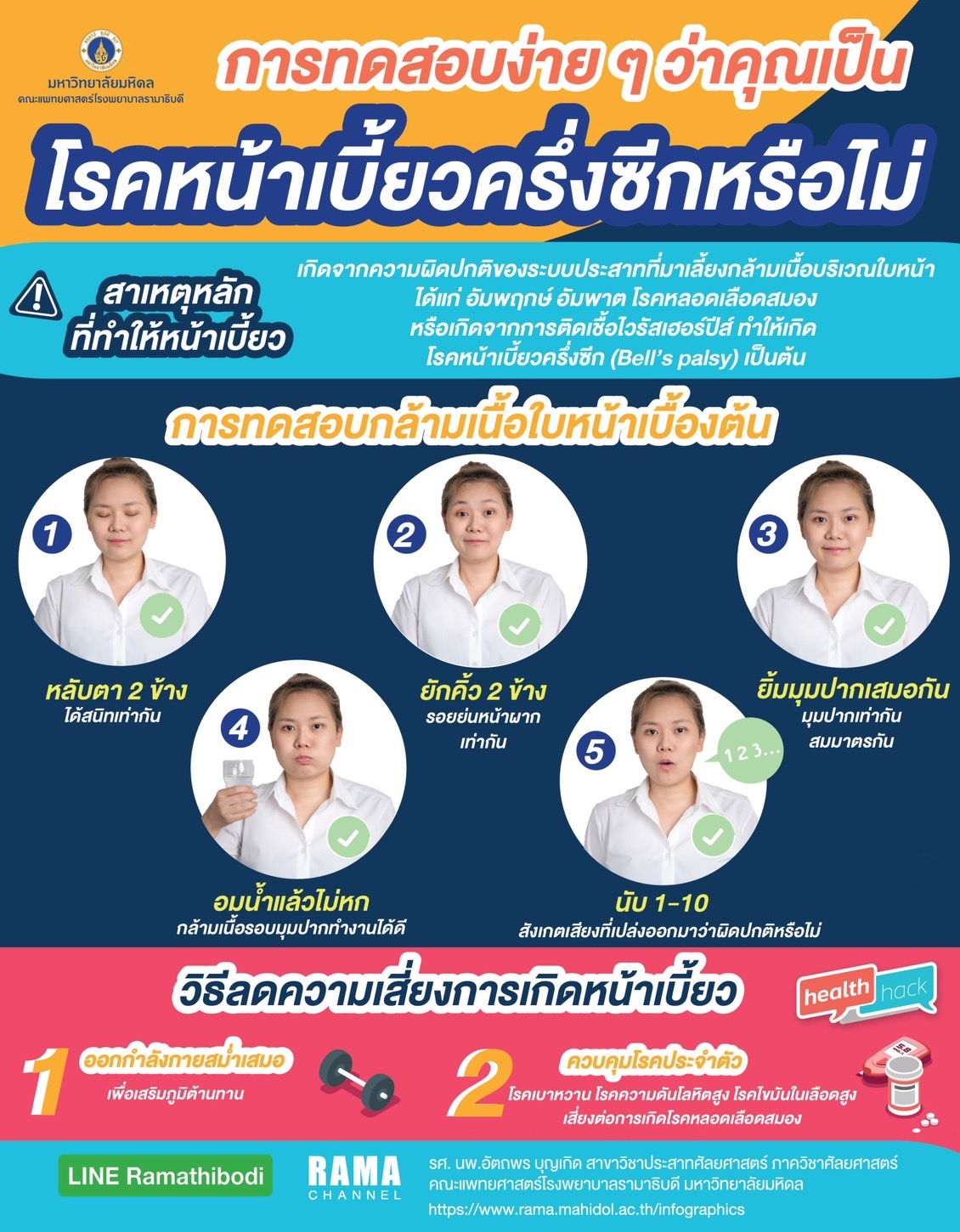 โรคหน้าเบี้ยวครึ่งซีก