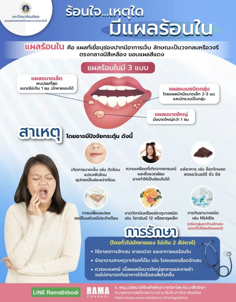 ร้อนใจ... เหตุใดมี แผลร้อนใน
