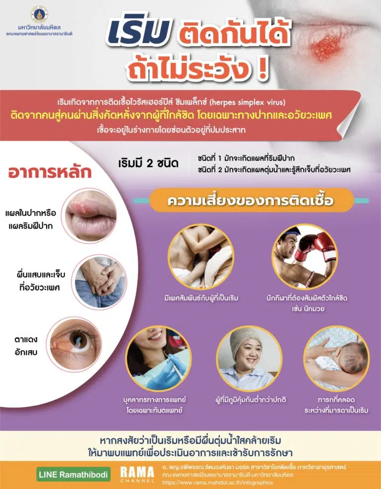 โรคเริม ติดกันได้ ถ้าไม่ระวัง