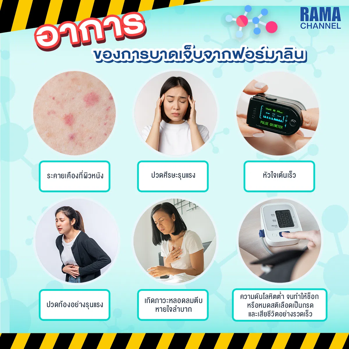 ฟอร์มาลิน, พิษจากฟอร์มาลิน, อาการของการได้รับพิษฟอร์มาลิน