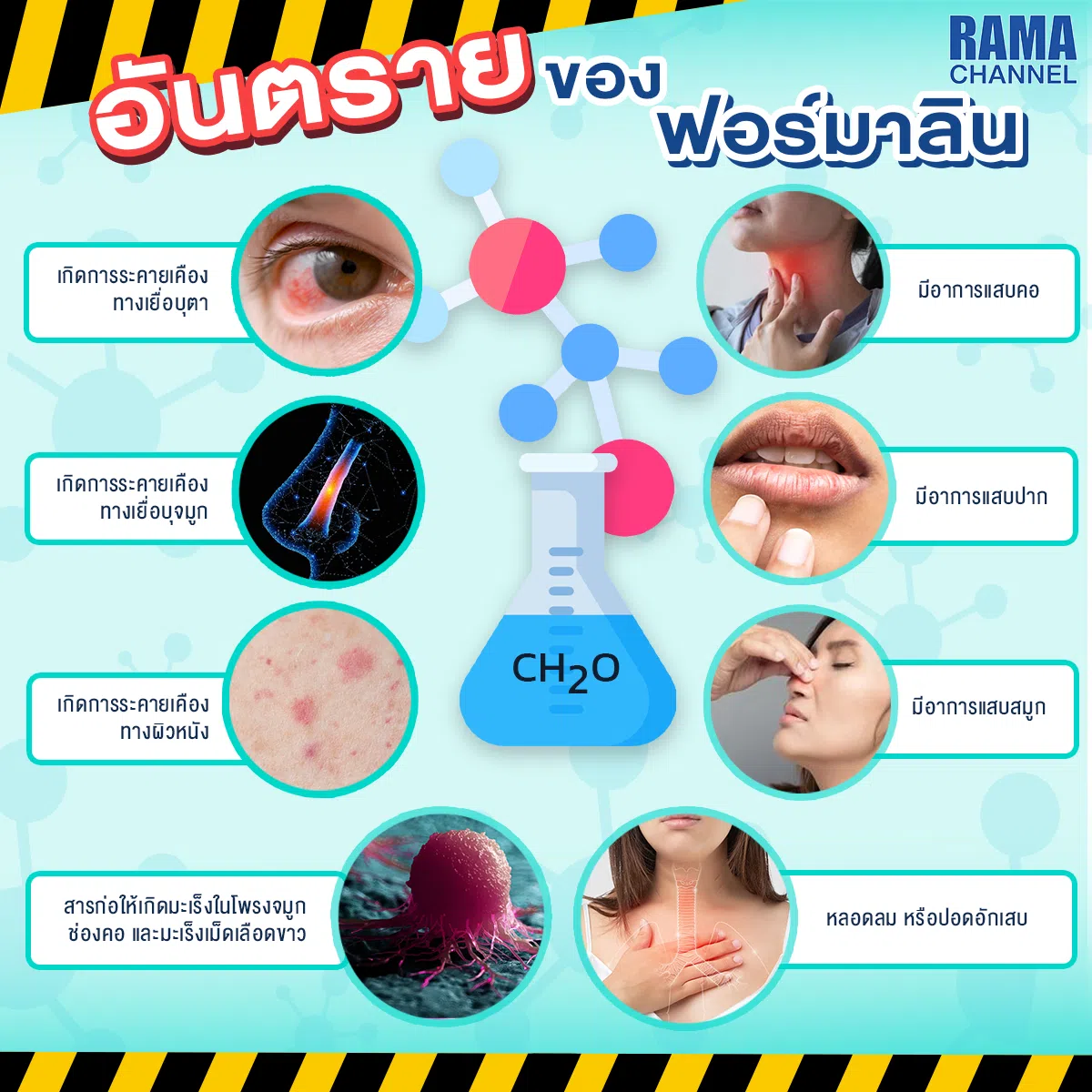 อาการแพ้ฟอมารีน แพ้ฟอมารีน แพ้สารปนเปื้อน