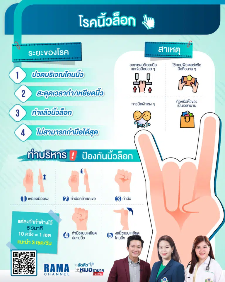 โรคนิ้วล็อก,นิ้วล็อก,ท่าบริหารนิ้ว,นิ้วล็อก
