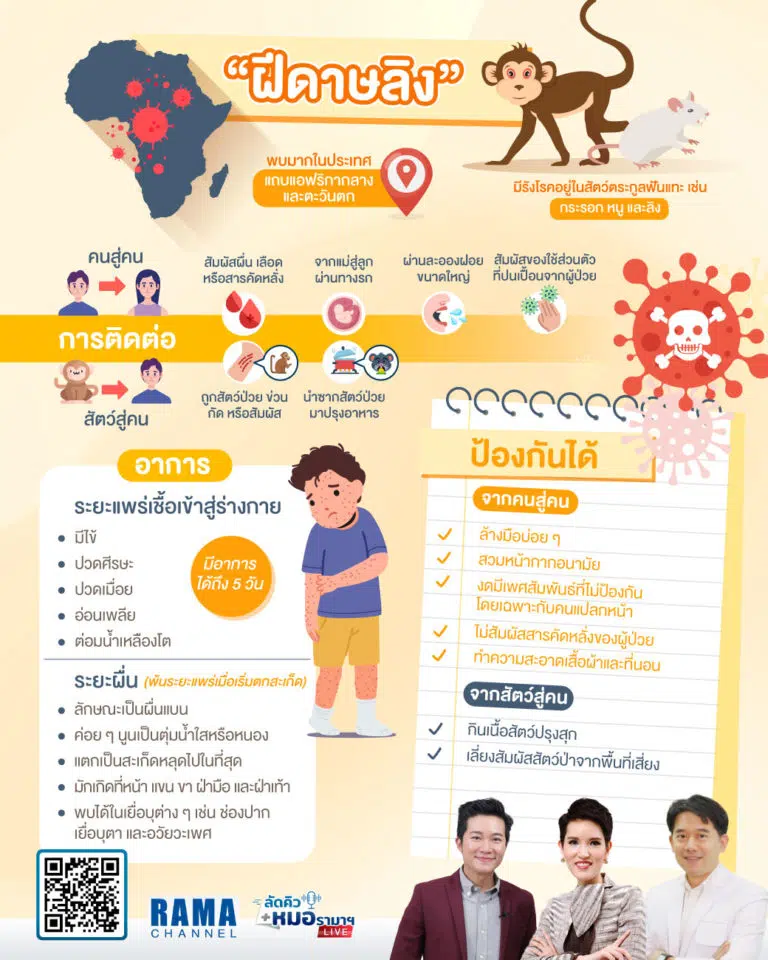 โรคฝีดาษลิง,ฝีดาษลิง,ไวรัสฝีดาษลิง,ลิง,เชื้อจากลิงสู่คน