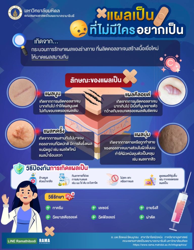 แผลเป็นที่ไม่มีใครอยากเป็น,แผลเป็น,แผลเป็นเกิดได้อย่างไร,วิธีป้องกันแผลเป็น,แผลเป็นรักษาอย่างไร,ไม่อยากเป็นแผลเป็นทำอย่างไร