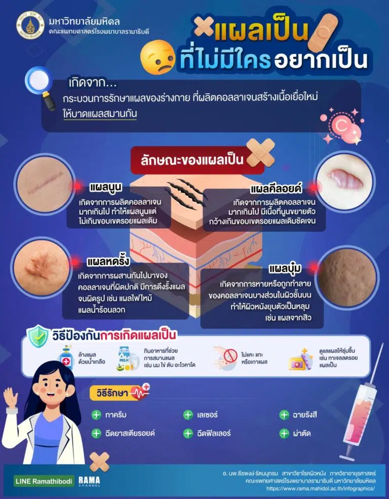 แผลเป็นที่ไม่มีใครอยากเป็น,แผลเป็น,แผลเป็นเกิดได้อย่างไร,วิธีป้องกันแผลเป็น,แผลเป็นรักษาอย่างไร,ไม่อยากเป็นแผลเป็นทำอย่างไร