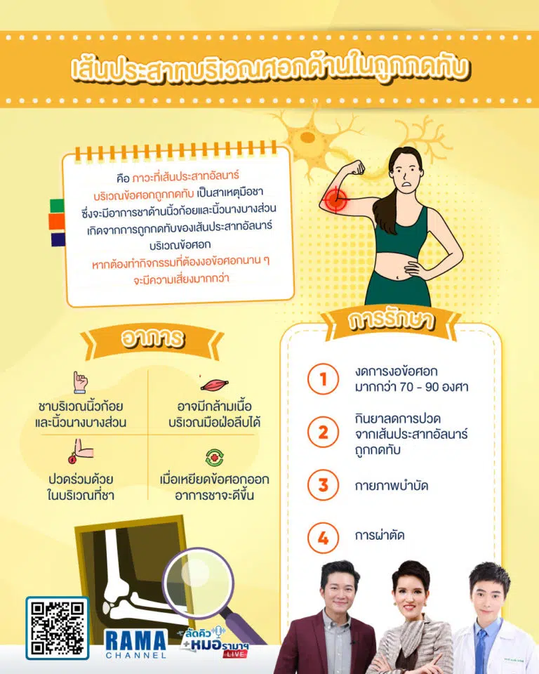 ภาวะเส้นประสาทข้อศอกถูกกดทับ,เส้นประสาทข้อศอกถูกกดทับ,มือชา,เส้นประสาทข้อศอก