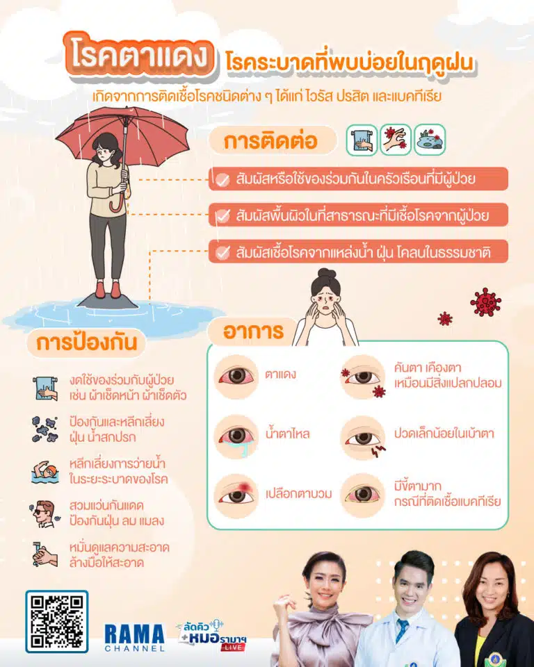 โรคตาแดง - ลัดคิวหมอ 14/09/66 | by RAMA Channel