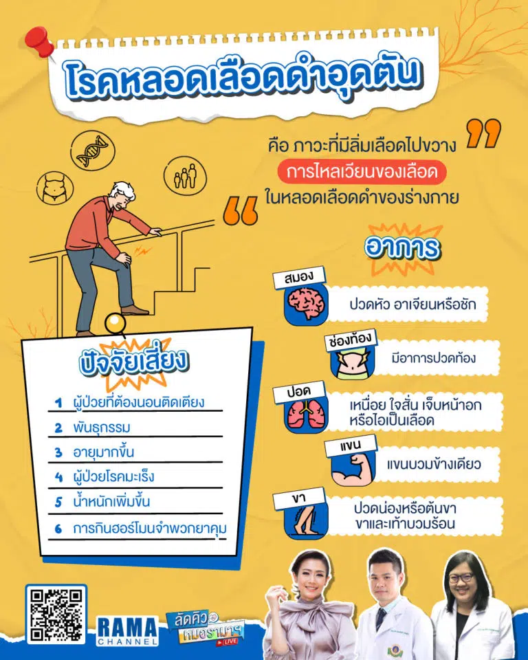 โรคหลอดเลือดดำอุดตัน