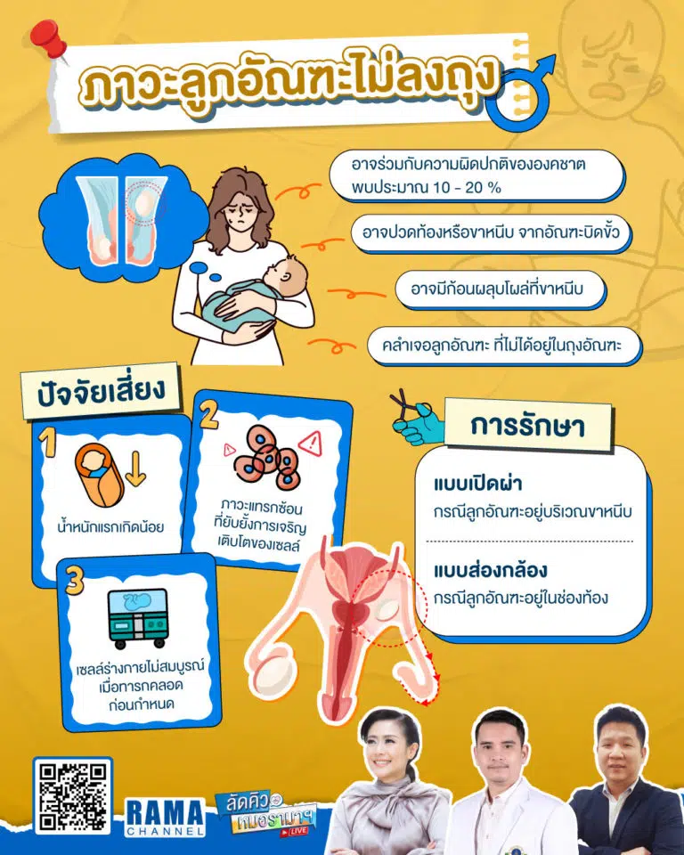 ภาวะลูกอัณฑะไม่ลงถุง