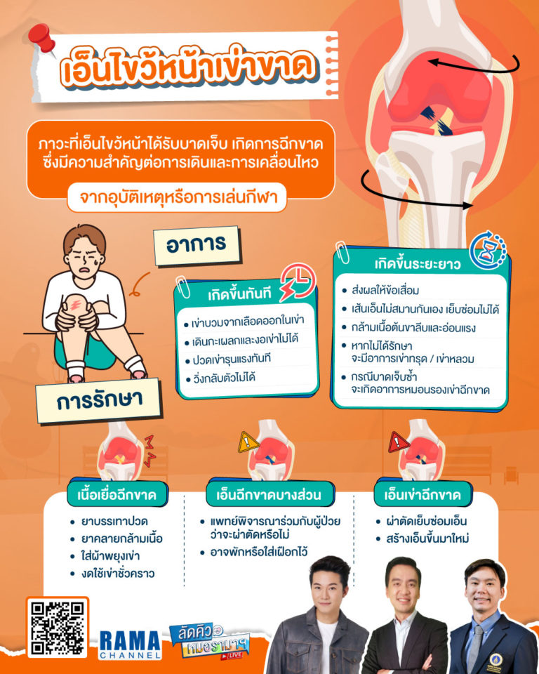 เอ็นไขว้หน้าเข่าขาด