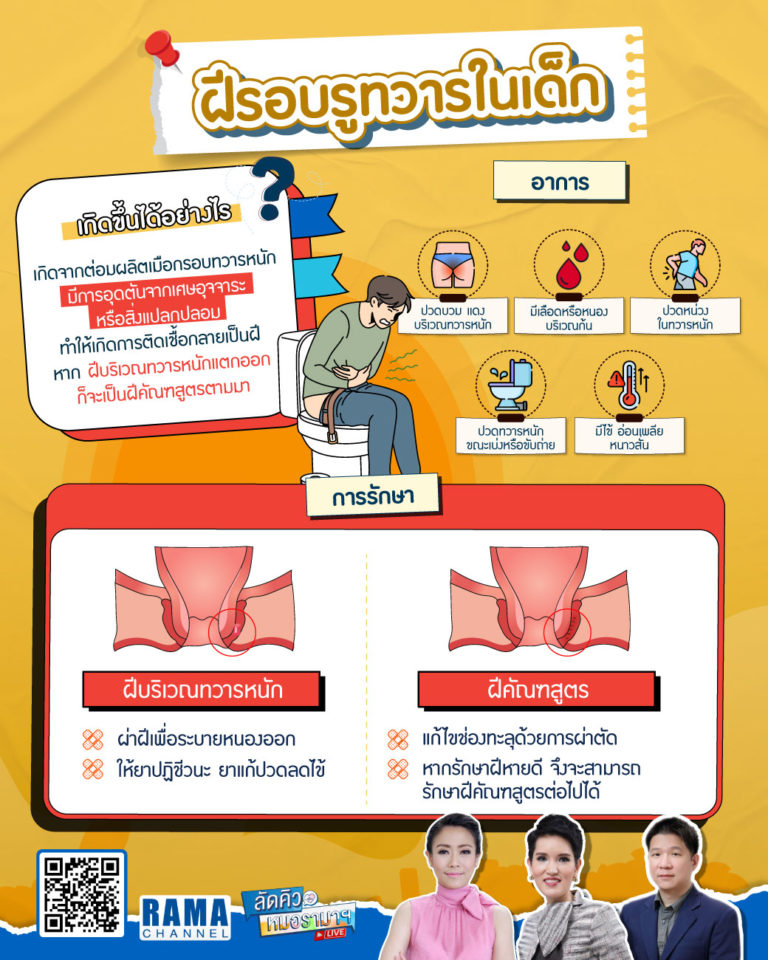ฝีรอบรูทวารในเด็กเล็ก
